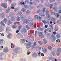 Cancer Genomics